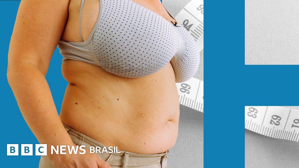 ‘Me diziam que eu era sortuda, mas eu sofria’: como ter seios grandes pode afetar sua saúde